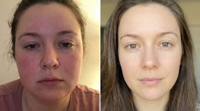 Why Your Face is Holding a Grudge (and How to Hack the “Stress Puff”)